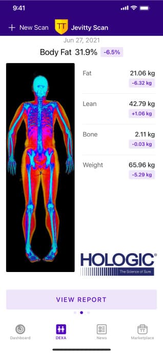 Jevitty health data dashboard screen, 1 of 4