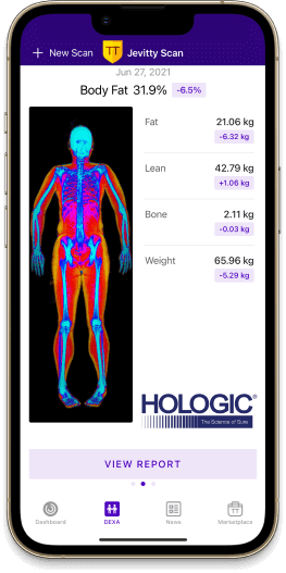 Jevitty health app on iPhone, screen 3